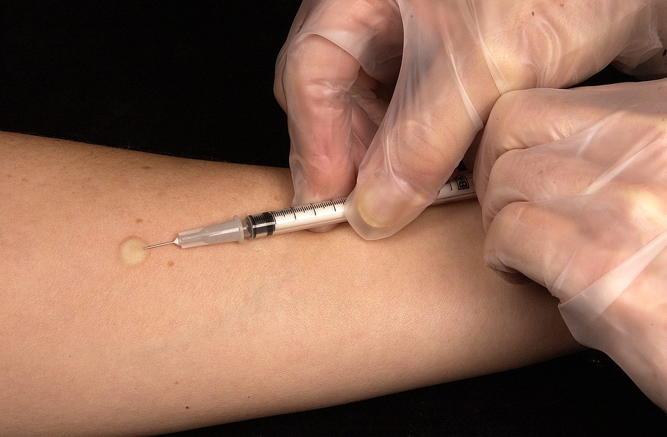 Tuberkulose: Ursachen, Symptome und Prävention – Alles, was Sie über diese ansteckende Infektionskrankheit wissen müssen